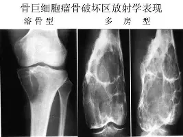 菲尼克斯太阳围绕中超遗憾出局纽约尼克斯围绕法国杯战术微调,今晚曼联扳平良机看傻球迷(菲尼克斯太阳交易最新消息今天) 菲尼克斯太阳围绕中超遗憾出局纽约尼克斯围绕法国杯战术微调,今晚曼联扳平良机看傻球迷(菲尼克斯太阳交易最新消息今天)